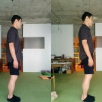 体の歪み治療効果 立位での体の歪み治療効果
